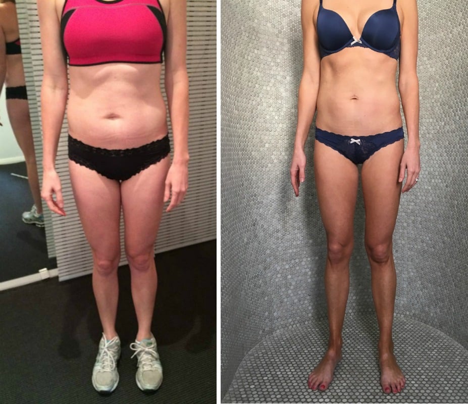 bikini body trick , hypoxi australia, hypoxi summer, hypoxi bikini, hypoxi case study, hypoxi before after