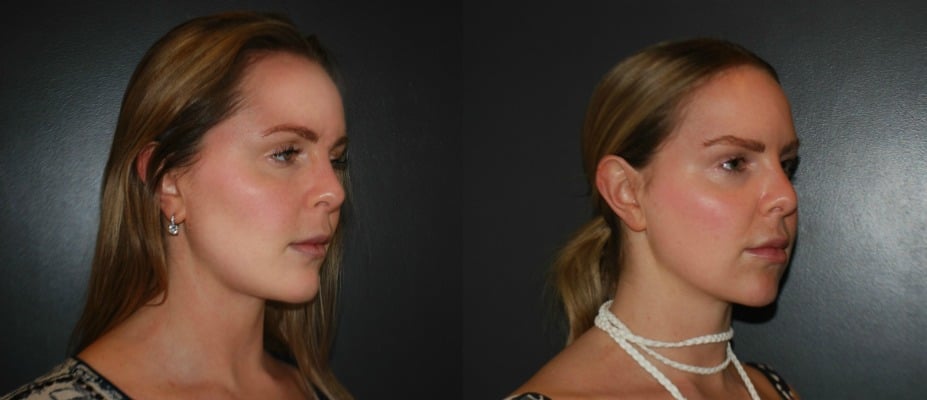 before-and-after
